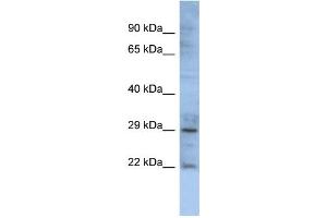 WB Suggested Anti-GJB1 Antibody Titration:  0.