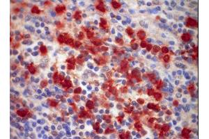 Image no. 1 for anti-S100 Calcium Binding Protein A9 (S100A9) antibody (ABIN379944) (S100A9 antibody)