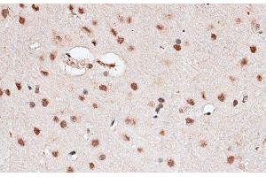 Immunohistochemistry of paraffin-embedded Rat brain using RBM3 Polyclonal Antibody at dilution of 1:100 (40x lens). (RBM3 antibody)