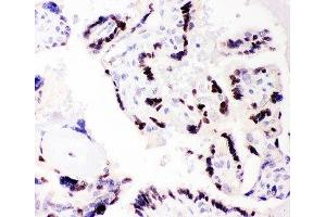IHC-P: C/EBP beta antibody testing of human placenta tissue