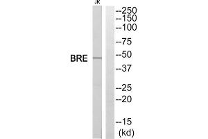 Western blot analysis of extracts from Jurkat cells, using BRE antibody. (BRE antibody  (C-Term))