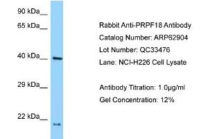 Western Blotting (WB) image for anti-PRP18 Pre-mRNA Processing Factor 18 (PRPF18) (N-Term) antibody (ABIN2789288) (PRPF18 antibody  (N-Term))