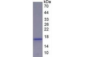 Rabbit Detection antibody from the kit in WB with Positive Control: Sample Rat Liver lysate. (Renin ELISA Kit)