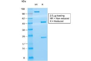 SDS-PAGE Analysis of Purified CD8a Mouse Recombinant Monoclonal Antibody ABIN6383871. (Recombinant CD8 alpha antibody)