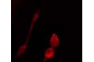 ABIN6274442 staining 293 cells by IF/ICC. (BRSK1 antibody  (Internal Region))