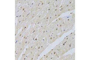 Immunohistochemistry (Paraffin-embedded Sections) (IHC (p)) image for anti-Small Nuclear Ribonucleoprotein Polypeptide A (SNRPA) (AA 1-282) antibody (ABIN6148210)