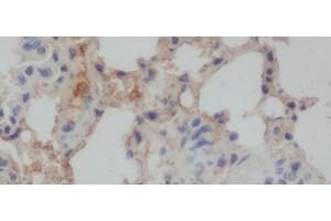 Immunohistochemistry of paraffin-embedded Rat lung using Aβ40 Polyclonal Antibody at dilution of 1:50 (Abeta 1-40 antibody)