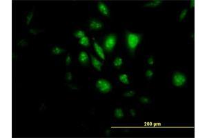 Immunofluorescence of monoclonal antibody to STK33 on HeLa cell. (STK33 antibody  (AA 1-514))