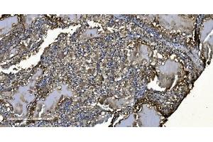 IHC analysis of MIEF1 using anti-MIEF1 antibody (ABIN7600396). (SMCR7L antibody  (AA 189-463))