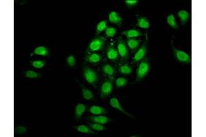 Immunofluorescence staining of A549 cells with ABIN7161832 at 1:100, counter-stained with DAPI. (NUP98 antibody  (AA 965-1110))