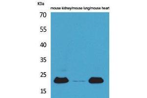 Adrenomedullin antibody  (Internal Region)