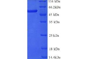 SDS-PAGE (SDS) image for delta Like Protein 3 (DLL3) (AA 27-492), (Extracellular) protein (His tag) (ABIN5714494) (DLL3 Protein (AA 27-492, Extracellular) (His tag))