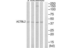 Western Blotting (WB) image for anti-Actin, beta-Like 2 (ACTBL2) (Internal Region) antibody (ABIN1852742) (ACTBL2 antibody  (Internal Region))