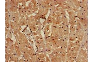Immunohistochemistry of paraffin-embedded human heart tissue using ABIN7152346 at dilution of 1:100 (SULF2 antibody  (AA 463-660))