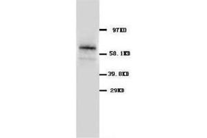 Western blot analysis of rat pancreas tissue lysis using GLAST antibody (SLC1A3 antibody  (C-Term))