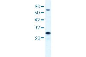 Western blot analysis of HepG2 cell lysate with MCM6 polyclonal antibody . (MCM6 antibody  (AA 771-820))