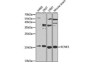 Western blot analysis of extracts of various cell lines, using KCNE1 antibody (ABIN3021634, ABIN3021635, ABIN3021636, ABIN1513121 and ABIN6215455) at 1:1000 dilution. (KCNE1 antibody  (AA 1-100))
