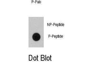 Image no. 1 for anti-B-Raf proto-oncogene, serine/threonine kinase (BRAF) (pThr400) antibody (ABIN358444) (BRAF antibody  (pThr400))