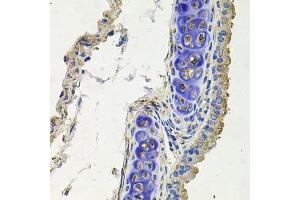 Immunohistochemistry of paraffin-embedded mouse lung using SKP1 antibody.
