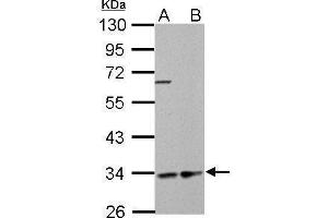 WB Image HADH antibody detects HADH protein by Western blot analysis. (HADH antibody)