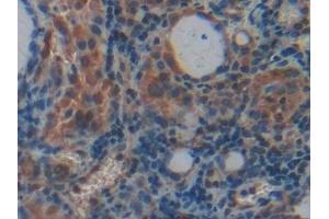 PLXNB1 antibody  (AA 200-727)
