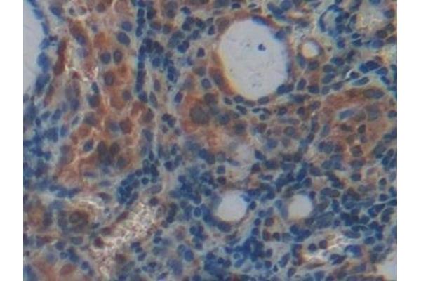 PLXNB1 antibody  (AA 200-727)
