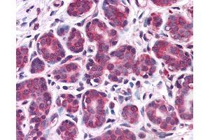 Anti-RBBP8 / CTIP antibody IHC of human breast. (Retinoblastoma Binding Protein 8 antibody  (AA 452-747))