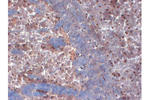 Immunohistochemistry (IHC) image for anti-Potassium Voltage-Gated Channel, Shaker-Related Subfamily, Member 6 (KCNA6) (C-Term) antibody (ABIN6658129)
