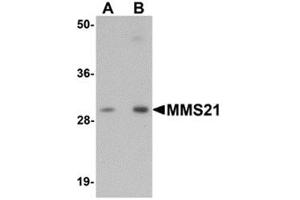 Western blot analysis of MMS21 in 293 cell lysate with MMS21 antibody at (A) 0.