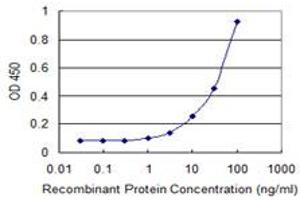Detection limit for recombinant GST tagged ESR1 is 1 ng/ml as a capture antibody. (Estrogen Receptor alpha antibody  (AA 41-140))