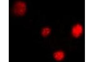 Immunofluorescent analysis of PPAR delta staining in U2OS cells. (PPARD antibody)