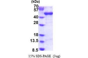 SDS-PAGE (SDS) image for ADP-Ribosylation Factor Interacting Protein 1 (ARFIP1) (AA 1-373) protein (His tag) (ABIN6387486)