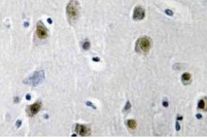 Immunohistochemistry (IHC) analyzes of ZBP-89 antibody in paraffin-embedded human brain tissue. (ZNF148 antibody)