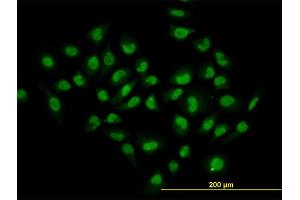 Immunofluorescence of monoclonal antibody to HDAC1 on HeLa cell. (HDAC1 antibody  (AA 1-482))