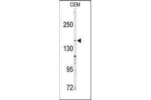 Western blot analysis of anti-ABCC4 Antibody (C-term) in CEM cell line lysates (35ug/lane). (ABCC4 antibody  (C-Term))