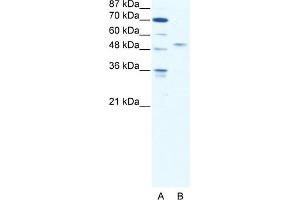 WB Suggested Anti-IRF5 Antibody Titration:  2. (IRF5 antibody  (N-Term))