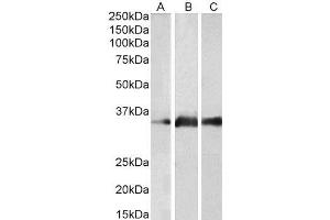 ABIN190841 (2µg/ml) staining of Human Brain (Cerebellum) (A), Mouse Brain (B) and Rat Brain (C) lysates (35µg protein in RIPA buffer). (Kallikrein 5 antibody  (Internal Region))