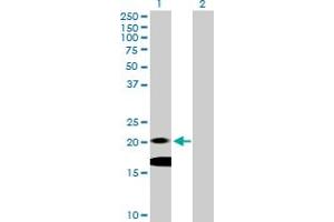 IL-7 antibody  (AA 1-177)