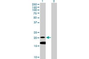 Western Blot analysis of IL7 expression in transfected 293T cell line by IL7 MaxPab polyclonal antibody. (IL-7 antibody  (AA 1-177))