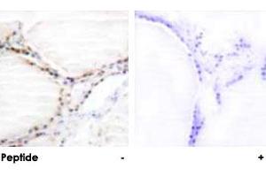 Immunohistochemical analysis of paraffin-embedded human thyroid gland tissue using VDR polyclonal antibody . (Vitamin D Receptor antibody  (Ser208))