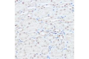 Immunohistochemistry of paraffin-embedded mouse kidney using NEDD9 Rabbit pAb (ABIN3023330, ABIN3023331, ABIN3023332 and ABIN6219606) at dilution of 1:100 (40x lens). (NEDD9 antibody  (AA 60-174))