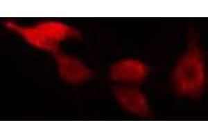 ABIN6266493 staining HeLa cells by IF/ICC. (RAD17 antibody  (C-Term))