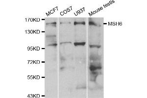 Western blot analysis of extracts of various cell lines, using MSH6 antibody. (MSH6 antibody)