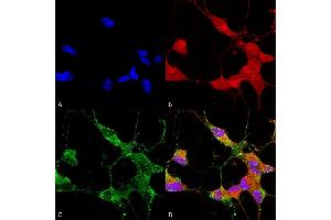 Immunocytochemistry/Immunofluorescence analysis using Mouse Anti-TrpC5 Monoclonal Antibody, Clone N67/15 (ABIN2485379). (TRPC5 antibody  (AA 827-845) (FITC))