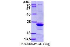 Image no. 1 for Endomucin (EMCN) protein (His tag) (ABIN1098339)