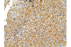 anti-Golgin A4 (GOLGA4) (Internal Region) antibody