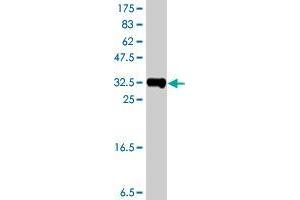 Western Blot detection against Immunogen (37. (SSBP3 antibody  (AA 1-102))