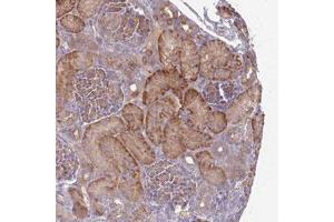 Immunohistochemical staining (Formalin-fixed paraffin-embedded sections) of human kidney with SAV1 polyclonal antibody  shows strong cytoplasmic positivity in renal tubules. (SAV1 antibody)