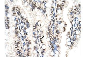 Immunohistochemistry (IHC) image for anti-RUN Domain Containing 2A (RUNDC2A) (N-Term) antibody (ABIN2783094) (SNX29 antibody  (N-Term))