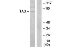Western blot analysis of extracts from MDA-MB-435 cells, using Tau (Ab-205) Antibody. (tau antibody  (AA 491-540))